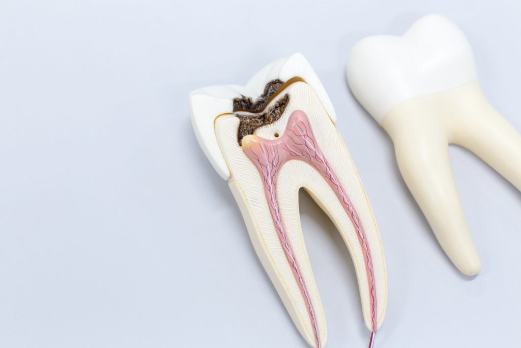 Endodontist in Grayslake